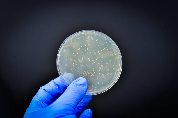 istockphoto-1333117925-612×612 Researcher displaying bacterial culture plate in microbiology food safety laboratory